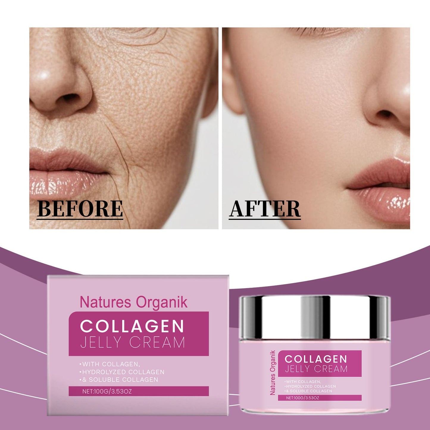 Collagen jelly cream packaging with 'Before' and 'After' skin comparison on a purple background.